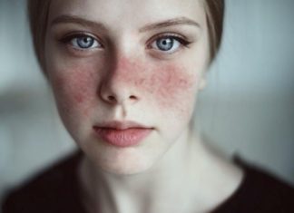 4 Common Skin Injuries and Simple Remedies