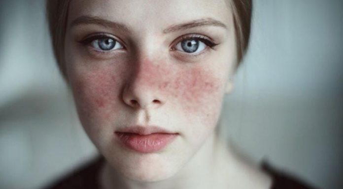 4 Common Skin Injuries and Simple Remedies