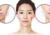 Good or bad character of concave face in physiognomy? How are women with concave faces?