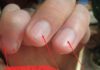 3 Nail Health Signs You Shouldn’t Ignore, Get Checked Now to Avoid Regret