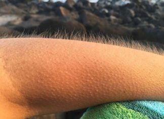 The Tingling Truth: Unveiling the Mystery Behind Goosebumps and Eye Twitches