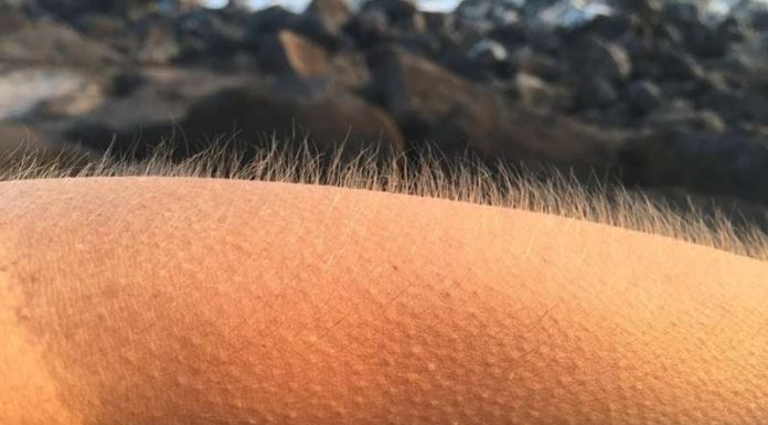 The Tingling Truth: Unveiling the Mystery Behind Goosebumps and Eye Twitches