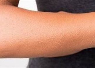 Unraveling the Goosebumps Enigma: Boon or Bane?