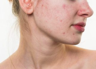 Avoid these 5 mistakes if you don’t want your skin to look tired, dull, and lifeless.