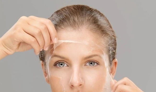 5 Effective Ways to Treat Acne Scars at Home for Smooth and Clear Skin