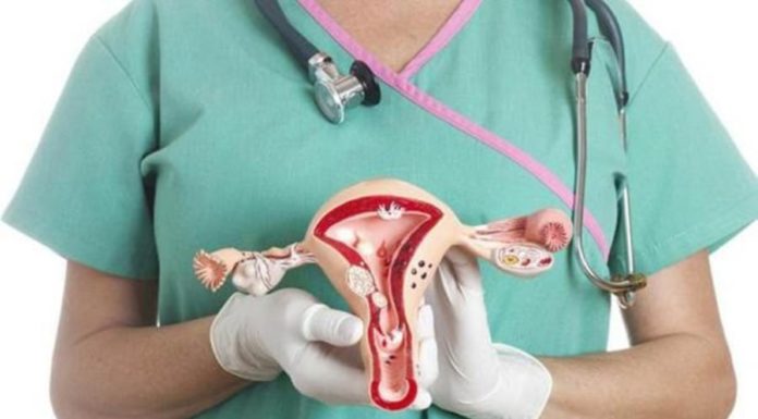 4 Warning Signs Telling Women to Get Their Ovaries Checked Right Away