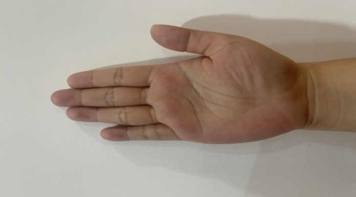 Unveiling the Meaning of the M-Shaped Fingerprint: A Rare Fortune Trait Bringing Wealth and Luck