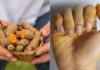 Turmeric-Stained Hands? Use This to Remove the Yellowish Hue