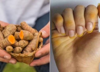 Turmeric-Stained Hands? Use This to Remove the Yellowish Hue