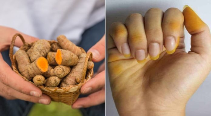 Turmeric-Stained Hands? Use This to Remove the Yellowish Hue