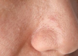 Effective Foaming Facial Cleansers For Oily Skin