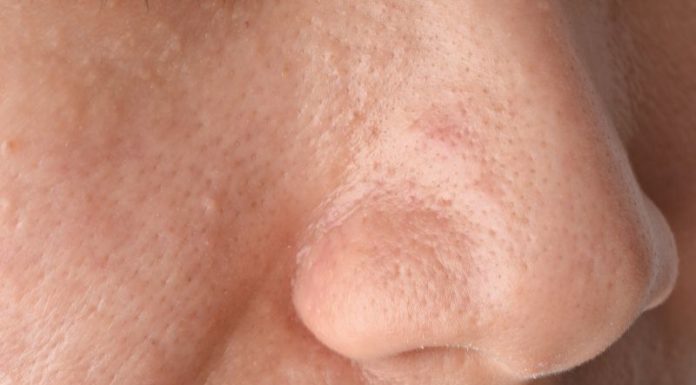 Effective Foaming Facial Cleansers For Oily Skin