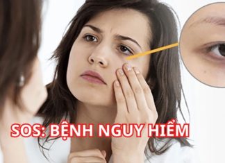 Why are you getting dark circles under your eyes? What other conditions can cause them?