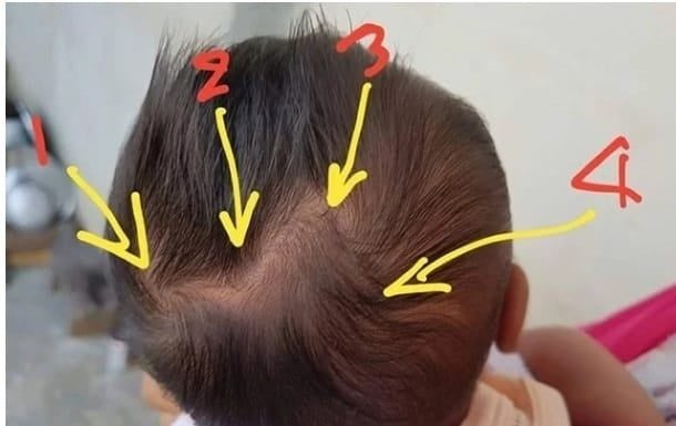 Toddlers With 2 Visible Crown Whorls Are Smarter, Says Doctor