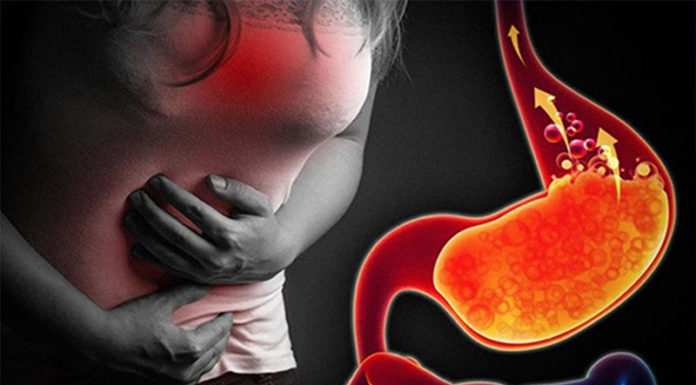 What to Eat When You Have Acid Reflux? Dietary Do’s and Don’ts for Acid Reflux Sufferers.