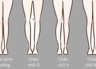 10 Simple Home Remedies to Fix Bow Legs in Adults