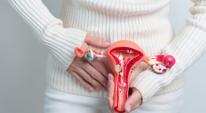 3 Types of Cancer That Are Increasingly Affecting Younger Women