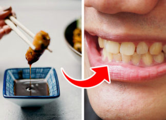 6 Reasons Why Your Teeth Are Turning Yellow