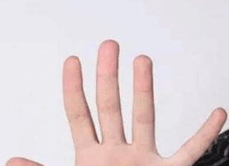 The Key to Riches: Unveiling Prosperity with 10 Singular Moles