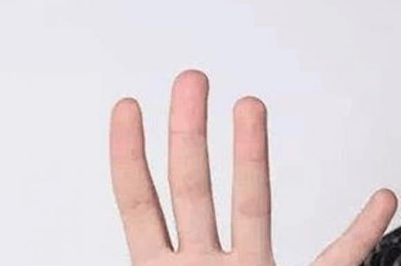 The Key to Riches: Unveiling Prosperity with 10 Singular Moles