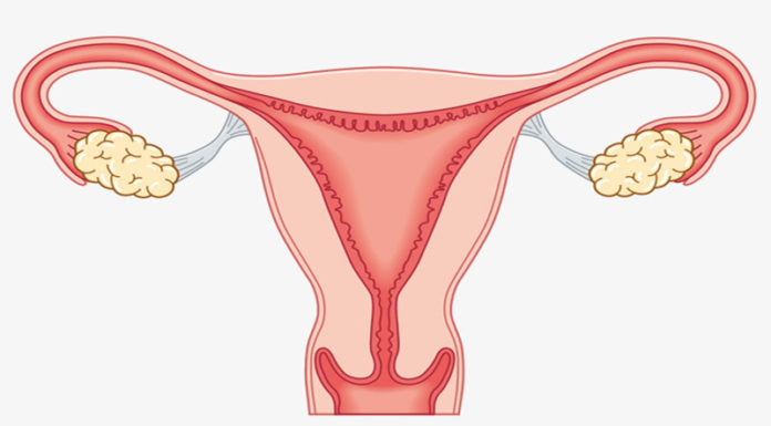 Eat More Fruit, Worry Less About Uterine Fibroids