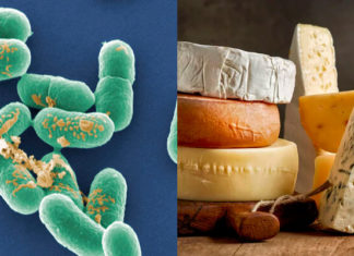 Is It Safe for Pregnant Women to Eat Cheese?