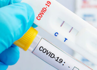 “COVID-19 At-Home Testing: How to Interpret False Positive Results, According to Doctors”