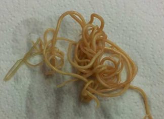 Dog Worm Infection: Signs, Symptoms, and Treatment