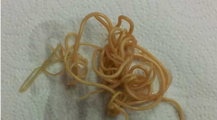 Dog Worm Infection: Signs, Symptoms, and Treatment