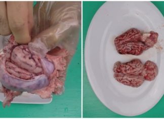 “The Ultimate Guide to Preparing Pork Brains: A Delicacy Done Right”