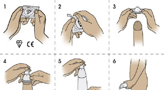 “A Comprehensive Guide to Condom Use: Everything You Need to Know”