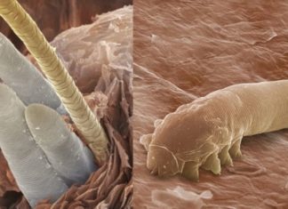 The Ultimate Guide to Treating Snake Bites in Dogs: Managing Mild to Severe Cases with Speed and Efficiency.