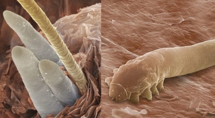 The Ultimate Guide to Treating Snake Bites in Dogs: Managing Mild to Severe Cases with Speed and Efficiency.