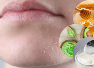 The Ultimate Winter Skin-Care Guide: Healing Dry and Cracked Skin