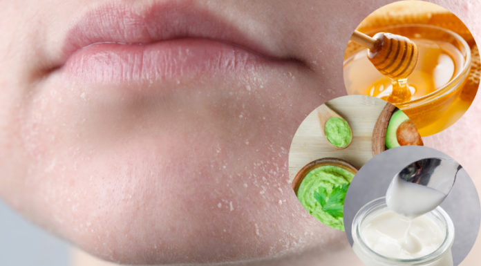 The Ultimate Winter Skin-Care Guide: Healing Dry and Cracked Skin