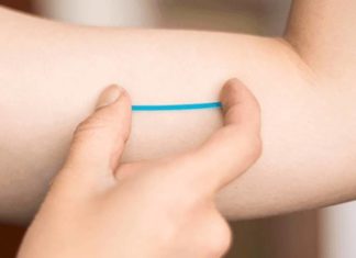 What is the Implant Birth Control? Is it Safe?