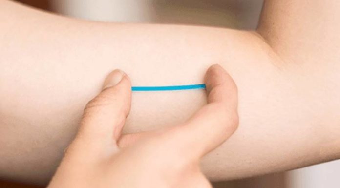 What is the Implant Birth Control? Is it Safe?