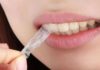 Should You Use Teeth Whitening Strips?