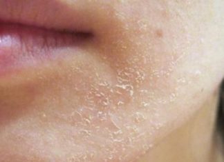 The Ultimate Skin SOS: 4 Warning Signs Your Skin is in Distress and How to Fix it.