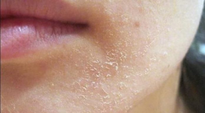 The Ultimate Skin SOS: 4 Warning Signs Your Skin is in Distress and How to Fix it.