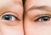5 Reasons Why the Skin Around Your Eyes is Wrinkling Early – Time to Make a Change!