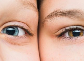 5 Reasons Why the Skin Around Your Eyes is Wrinkling Early – Time to Make a Change!