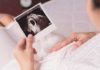 Signs of an Early Miscarriage: What to Look Out for in the First Trimester