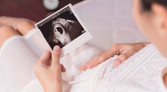 Signs of an Early Miscarriage: What to Look Out for in the First Trimester