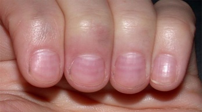 The Secrets Your Fingers Hold: Two Unassuming Signs That Reveal Serious Health Issues