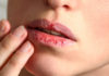 “The Pitfalls of Overusing Lip Balm: Why Less is More for Healthy Lips.”