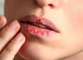 “The Pitfalls of Overusing Lip Balm: Why Less is More for Healthy Lips.”