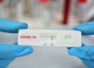 How Long Are COVID Test Results Valid For? Understanding the Timeline and Usage.