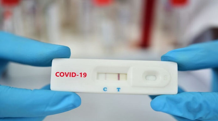 How Long Are COVID Test Results Valid For? Understanding the Timeline and Usage.