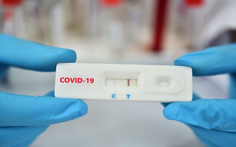 How Long Are COVID Test Results Valid For? Understanding the Timeline and Usage.